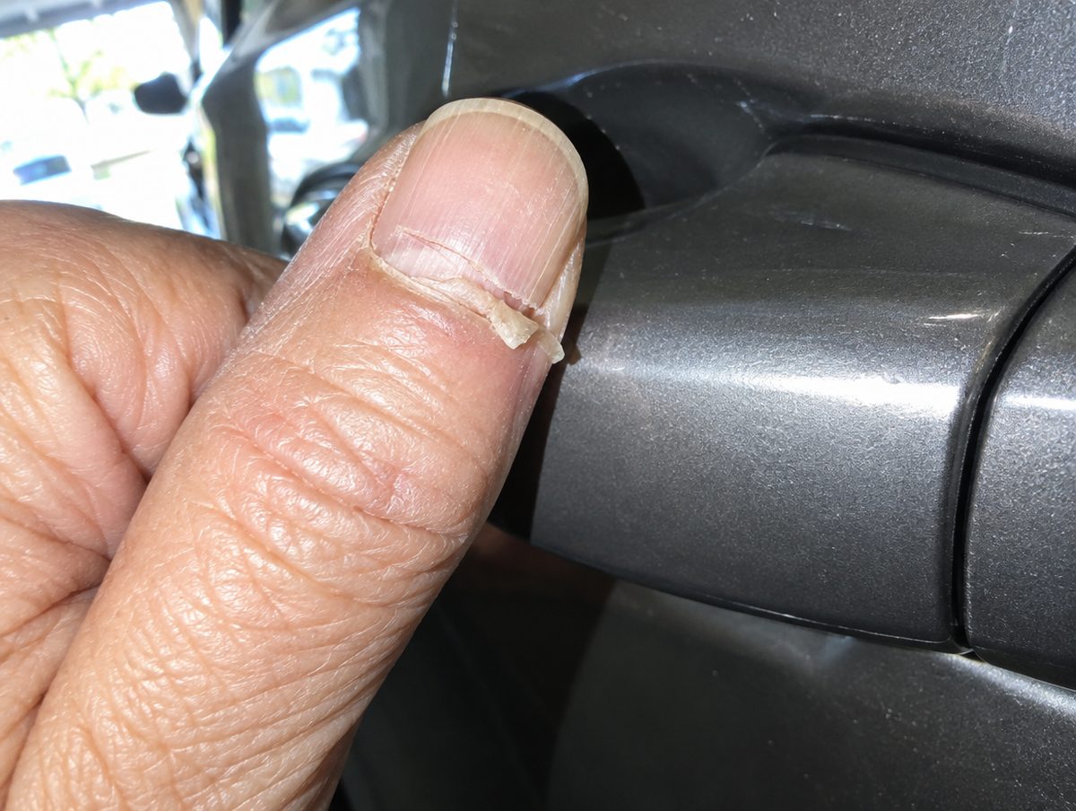 Your nails are not getting old. They are drying out.