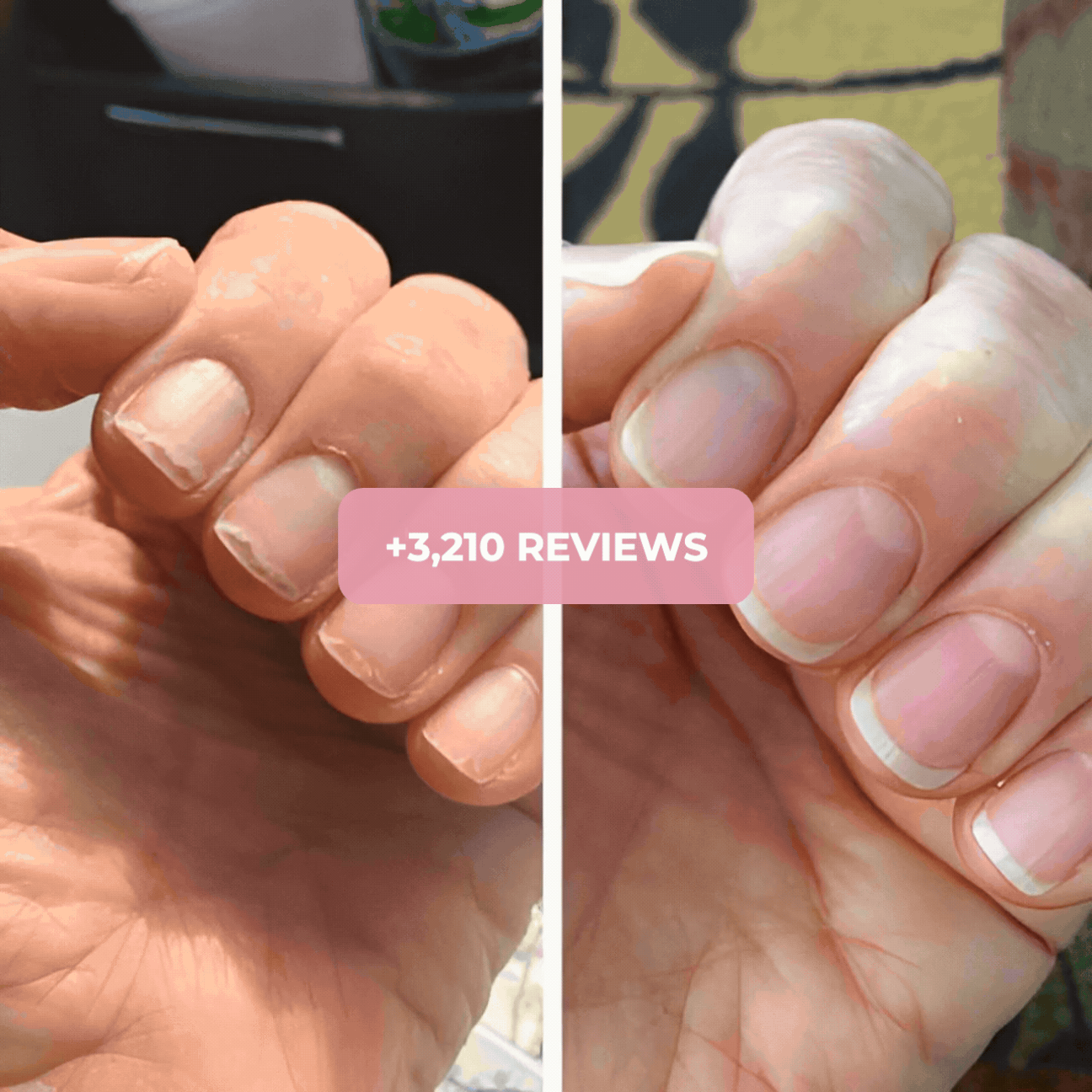 Try NAILZ for 90 days, risk-free.