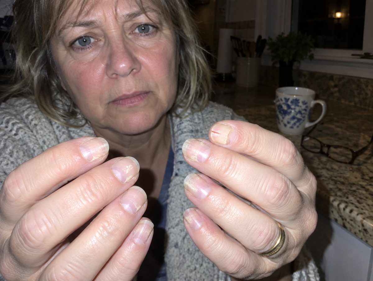 7 Reasons Women Over 50 Can't Grow Their Nails Anymore, and the 10-second fix that works